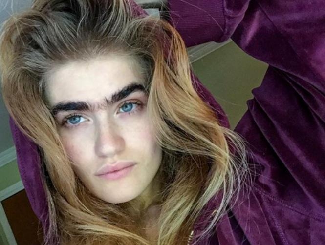 Photos: Model Brings Back the Unibrow in Viral Posts