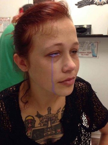 Photos: Eye Tattoo Leaves Model Partially Blind
