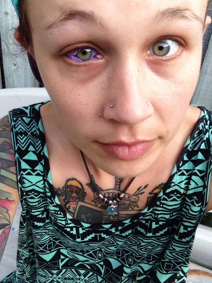 Photos: Eye Tattoo Leaves Model Partially Blind