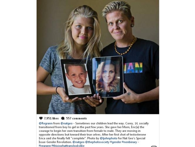 Daughter Comes out as Transgender. Inspires Father to Transition