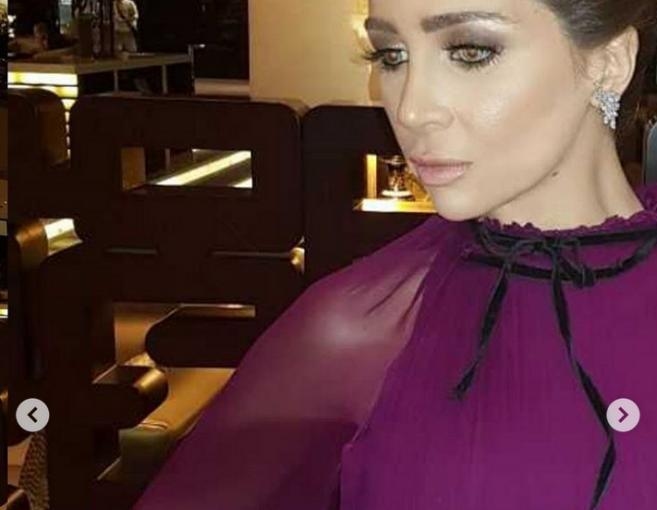 كيف أصبح شكل النجمة العربية بعد تجميل أنفها؟