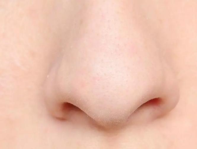 Those Blackheads on Your Nose Are Probably Something Else Altogether