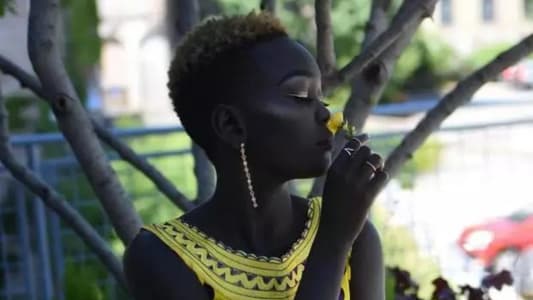 Model Reveals She Was Bullied for Being Too Black