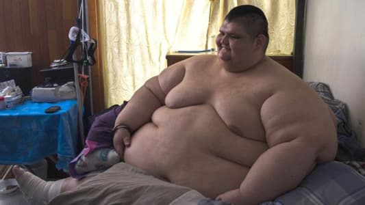 World's Most Obese Man Is Going on a Diet