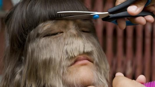 Photos: 'World's Hairiest Girl' Shaves Face to Marry Love of Her Life