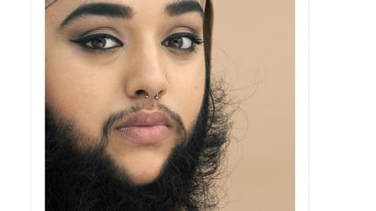 Photos: Women With Excessive Facial Hair Share Their Stories