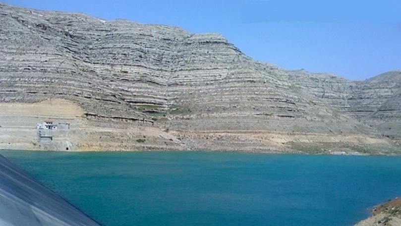 شكران مرتجى: هذه هي عمليات التجميل التي خضعت لها