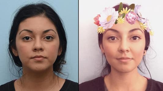 People Are Having Cosmetic Surgery to Look Like Snapchat Filters