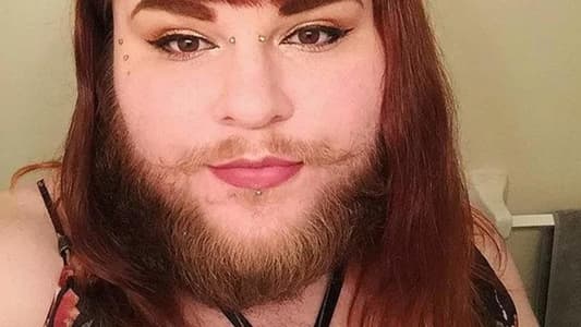 This Woman Is Embracing Her Beard After 14 Years of Shaving Her Face Every Day