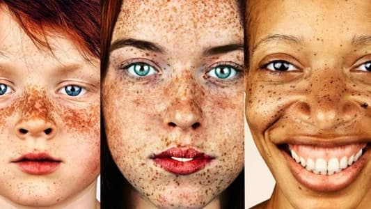 Photographer Takes Stunning Portraits of People with Freckles to Demolish the Stigma