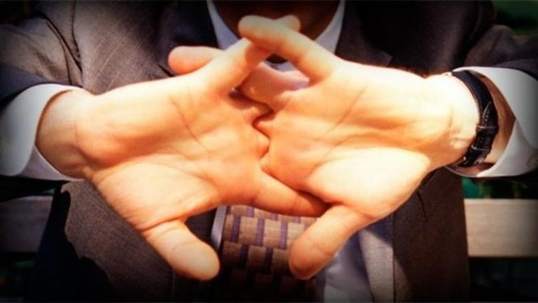 A Doctor Cracked His Knuckles for 50 Years to See If It Was Harmful