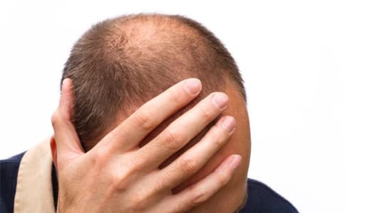 Is Stress Causing Hair Loss?