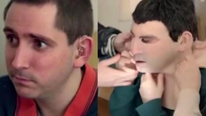 Man Allergic to Sun Gets Replica Mask of His Own Face