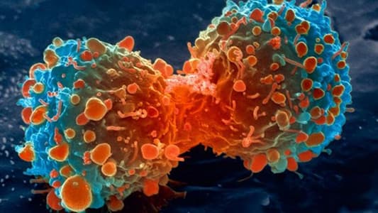 انتشار مرعب لمرض السرطان في لبنان