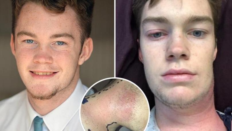 Main Highlight Image