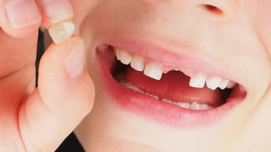 Teeth Can Be Used to Predict Mental Health Problems, Study Finds