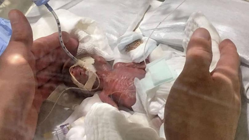 World's smallest baby boy goes home from Japan hospital