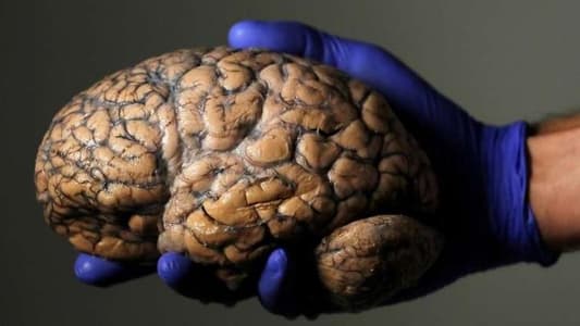 أول جراحة دماغيّة في العالم عن بعد 3 آلاف كلم