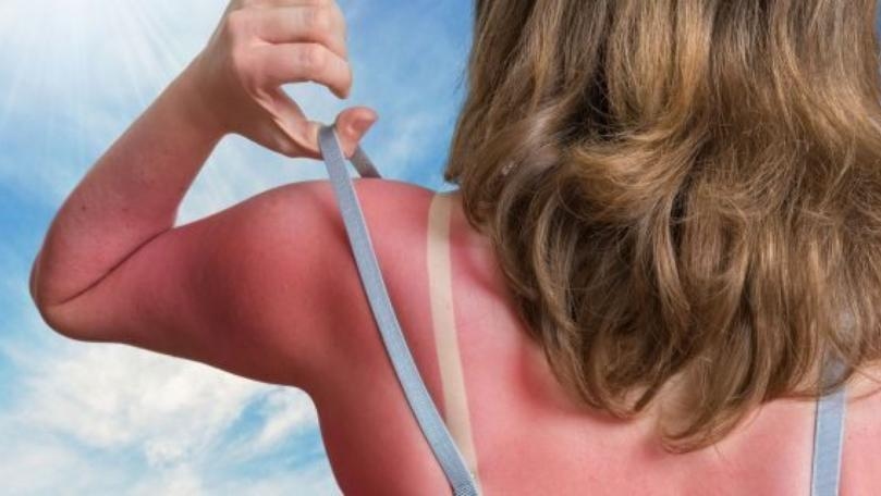 Can You Actually Reverse Sun Damage?
