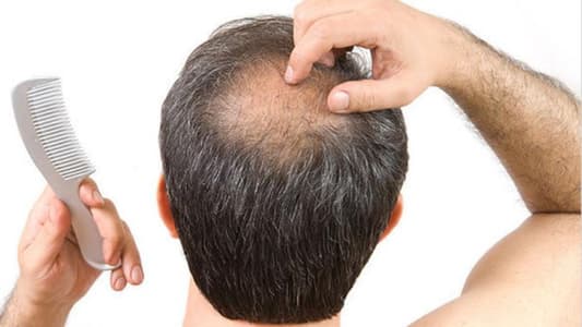 Expert Reveals Five Fruits That Could Stop You From Going Bald
