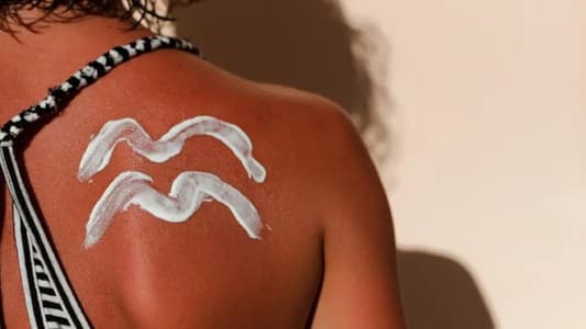 The Truth About Applying After-Sun on Sunburnt Skin, According to the Experts