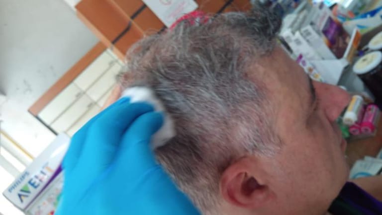 بالصورة: جرح المسؤول في حزب "سبعة" انطوان يمين نتيجة الضرب الذي تعرّض له من قبل قوى الأمن أمام مجلس النواب