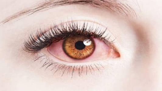 خفّفوا من استخدام الأجهزة الإلكترونية واحرصوا على التغذية السليمة لحماية العين من الضّرر