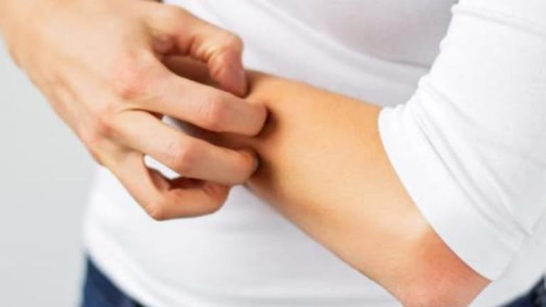 مرض "زونا" سببه التوتر وقد يؤدي الى العمى أو التهاب الدماغ 