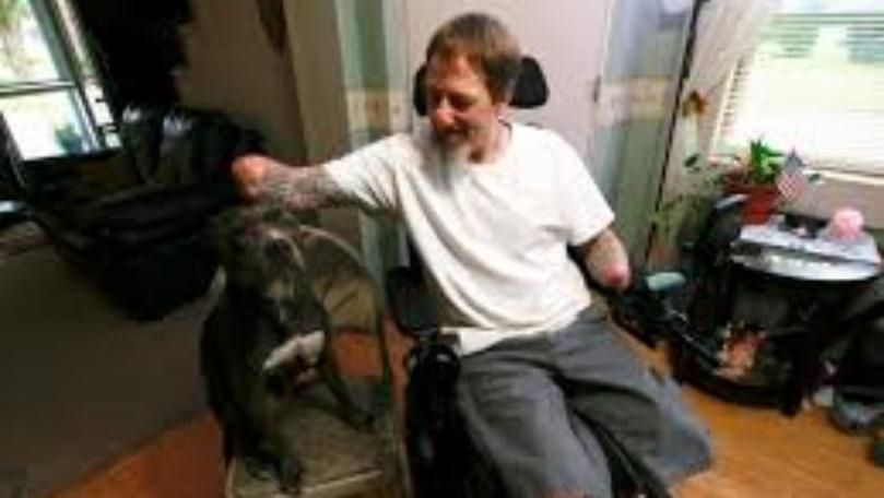 Man Who Lost Limbs After Dog Licked His Face Remains Loyal to His Pet