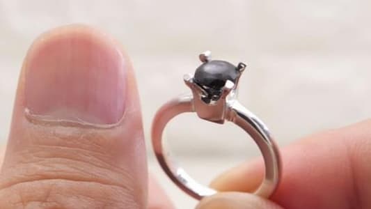 Man Used Year’s Worth of Toenail Clippings to Make Engagement Ring