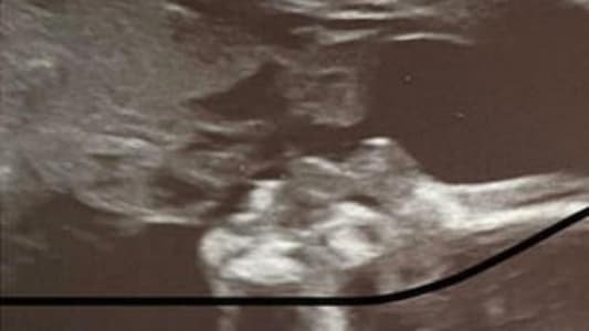 Mother Claims Ultrasound Photo Shows Her Late Father Kissing Unborn Child