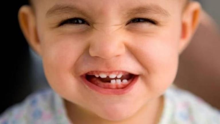 الأطعمة اللزجة والخفيفة تدمران أسنان الأطفال 