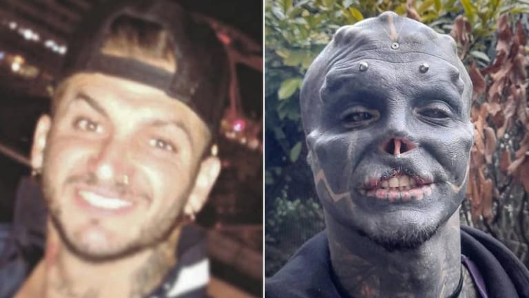 Man Turns Himself Into ‘Black Alien’ by Removing Nose and Top Lip