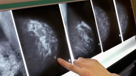 Google AI Can Spot Possible Breast Cancer Better Than Trained Experts