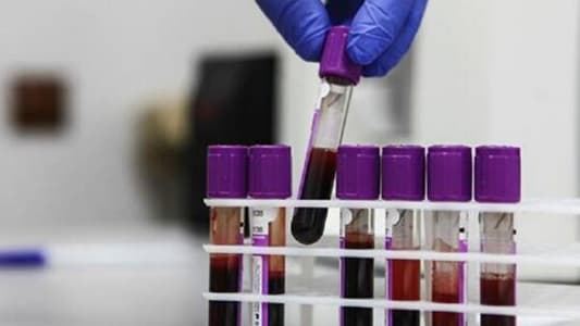 ابتكار مستحضر للعلاج الجيني من دم المريض