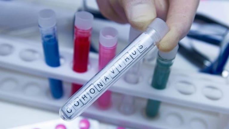 133 إصابة بـ"كورونا" مثبتة مخبرياً في لبنان