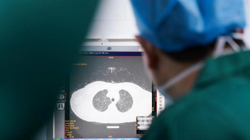 Woman May Have Developed Brain Disease Due to Covid-19, Doctors Say