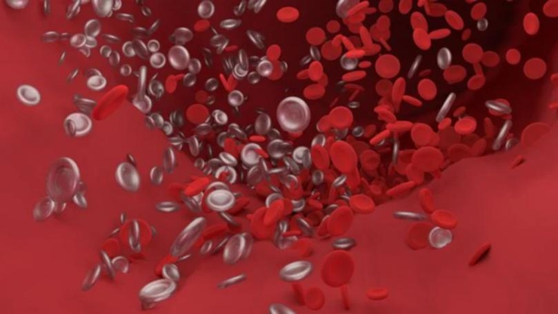 Coronavirus Causes Damaging Blood Clots From Brain to Toes