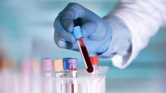 Blood Test Can Predict How Prostate Cancer Will Respond to Treatment
