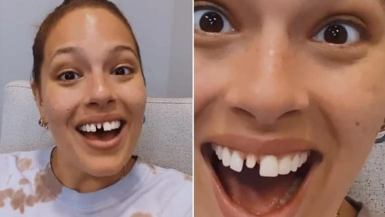 Model Ashley Graham Reveals Broken Tooth After Eating Her Mom's Frozen Cookies