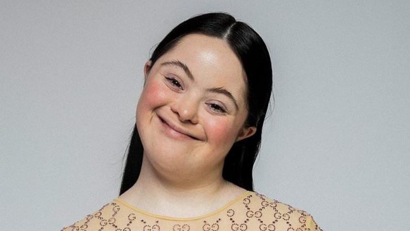 Model with Down’s syndrome Stars in Gucci Campaign in Italian Vogue