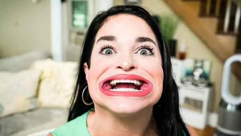 TikTok Star's 2.56-Inch Mouth Gape Earns Guinness World Record