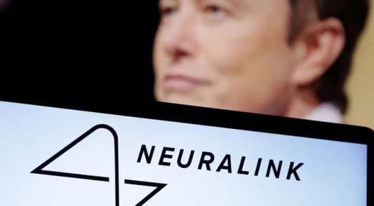Elon Musk's Neuralink says it has FDA approval for study of brain implants in humans