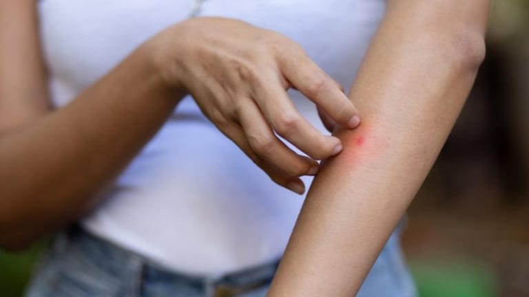 هلعٌ من الملاريا في لبنان... بين الرّعب والحقيقة!