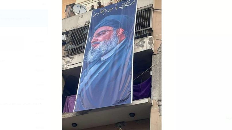 بالصّور: "فداء لنعليك"... قبل وبعد!