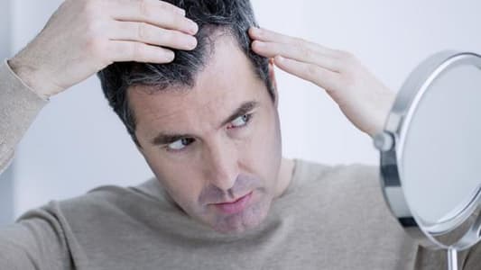 Quarter of Patients Experience Hair Loss in Six Months After Covid Infection, Study Warns