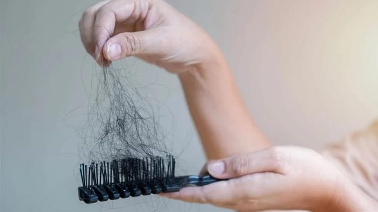 هكذا يُسبّب التوتّر تساقط الشّعر