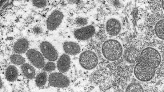 Canada Confirms First Two Monkeypox Cases