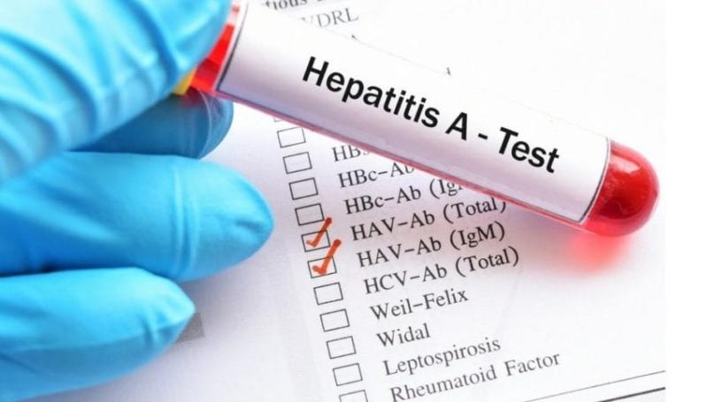 Health Ministry: 555 cases of Hepatitis A have been registered today in Lebanon, most of which are in the Bekaa with 217 cases and in the North with 202 cases, and most of them are among people aged between 5 and 19 years