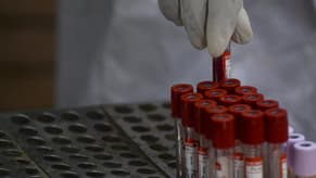 اختبار دم قد يكشف 50 نوعاً من السرطان